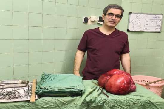 خارج کردن توده سنگین از شکم بیمار پس از سال‌ها درد